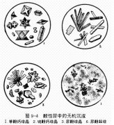 尿酸盐结晶是什么？