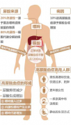尿酸偏高的原因是什么？该如何科学专业降尿酸