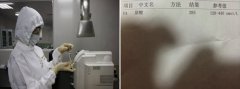 尿酸多高才算高，正常尿酸值是多少