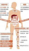 痛风不同时期的治疗方法